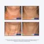 NeoStrata Skin Active Dr. Express Triple Firming Halscreme, 87 ml