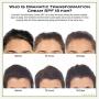 VERTERE - Dramatic Transformation Cream- SPF 18 (30 ml)