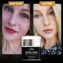 Retinol Moisturizer for Face and Eye area | Anti Aging Cream with Hyaluronic Acid, 2.5% Active Retinol and Vitamin E | Reduces Appearance of Wrinkles and Fine lines | Best Day and Night Face Cream