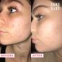 Sand & Sky Australian Pink Clay Porefining Face Mask Skin Care | Pink Clay Face Mask | Pore Minimizer & Pore Cleaner with Face Mask Brush Applicator