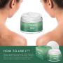 Scar Removal Cream Advanced Treatment for Old & New Scars from Cuts Stretch Marks, C-Sections & Surgeries With Natural Herbal Extracts Formula