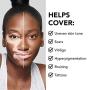 Dermablend Cover Creme Full Coverage Cream Foundation with SPF 30, 1 Oz