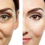 Retinol Moisturizer Cream High Strength for Face and Eye Area Miracle Plus - 2.5% Retinol, Hyaluronic Acid, Vitamin E, Green Tea - Anti aging Formula Reduces Wrinkles, Fine Lines, Spots-Day and Night