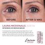 L’amore Beauty Intensive Eye Repair Serum (15 ml) Anti-Aging Collagen Booster Eye Cream with Retinol - Under Eye Treatment For Puffy Bags, Dark Spots, Fine Lines, Wrinkles - Made In USA