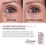 L’amore Beauty Intensive Eye Repair Serum (15 ml) Anti-Aging Collagen Booster Eye Cream with Retinol - Under Eye Treatment For Puffy Bags, Dark Spots, Fine Lines, Wrinkles - Made In USA