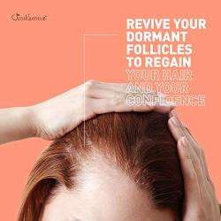 Bald Spot Treatment | Scalp Spot Cream