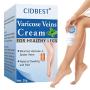 Varicose Veins Cream, Spider Veins Cream, Varicose Vein Treatment, Strengthen Capillary Health, Improve Blood Circulation, Relief Phlebitis Angiitis Inflammation