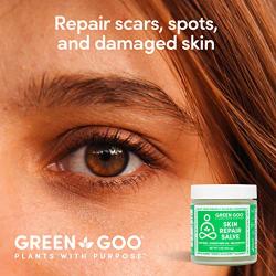 Green Goo Natural Acne Scar Removal and Spot Treatment Cream, Damaged Skin Repair (4 Ounce Jar)