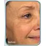 Biologic Stem Cell Wrinkle Therapy - (Set of 2)
