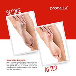 Probelle Advanced Total Foot Cream: Soothes, Hydrates, Rejuvenates Rough, Dry, Cracked & Sore Feet, 3 ounce