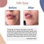 LilyAna Naturals Retinol Cream for Face - Retinol Cream, Anti Aging Cream, Retinol Moisturizer for Face, Wrinkle Cream for Face, 2.5% Retinol Complex - 1.7oz