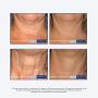 NeoStrata Skin Active Triple Firming Neck Cream, 2.8 oz