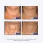 NeoStrata Skin Active Dr. Express Triple Firming Halscreme, 87 ml