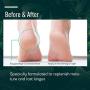 Ellocy Urea 40% Foot Cream Plus Salicylic Acid 4.2 Oz, Best Callus Remover - Moisturizes and Rehydrates Feet, Knees & Elbows - For Thick, Cracked, Rough, Dead & Dry Skin