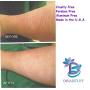 Extreme Crepey Skin Body & Face Cream With Hyaluronic Acid, Alpha Hydroxy and More, by Diva Stuff (Frosted Lime Cupcake)