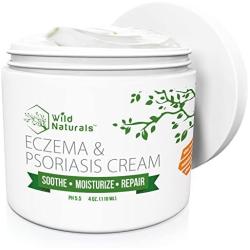 Wild Naturals Eczema Psoriasis Cream - for Dry, Irritated Skin, Itch Relief, Dermatitis, Rosacea, and Shingles. Natural 15-in-1 Formula Promotes Healing and Calms Redness, Rash and Itching Fast