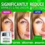 Anti Aging Retinol Moisturizer Cream for Face, Neck & Décolleté - Made in USA - Wrinkle Cream for Women and Men with Hyaluronic Acid and Active Retinol 2.5% - Best Day and Night - Results in 4 Weeks Anti Aging Retinol Moisturizer Cream for Face, Neck & Décolleté - Made in USA - Wrinkle Cream for Women and Men with Hyaluronic Acid and Active Retinol 2.5% - Best Day and Night - Results in 4 Weeks