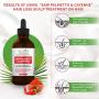 Saw Palmetto & Cayenne Hair Loss Scalp Treatment. DHT Blocker, Organic Hair Growth Oil For Hair Thinning Prevention Postpartum Alopecia. Capsaicin, 4 oz.