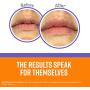 OKeeffes Lip Repair Night Treatment Lip Balm .25oz Jar