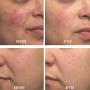 First Aid Beauty Ultra Repair Cream, Intense Hydration, 14 oz (Original)