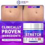 Stretch Marks & Scars Defense Cream Daily Moisturizer w Organic Shea Butter + Plant Oils + Vitamins to Prevent, Reduce and Fade Away Old or New Scars Best for Pregnancy 2oz