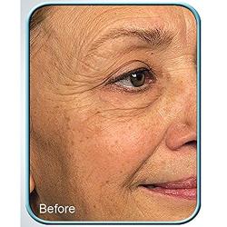 Stem Cell Therapy by BioLogic Solutions (Set of 2 Jars)