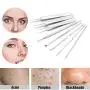 Pinkiou Blackhead Entferner Comedone Pickel-Entferner Extraktionstool Set Behandlung für Mitesser und Pickel, 8-in-1 mit Metallkoffer