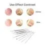 Pinkiou Blackhead Entferner Comedone Pickel-Entferner Extraktionstool Set Behandlung für Mitesser und Pickel, 8-in-1 mit Metallkoffer