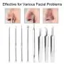 Pinkiou Blackhead Entferner Comedone Pickel-Entferner Extraktionstool Set Behandlung für Mitesser und Pickel, 8-in-1 mit Metallkoffer